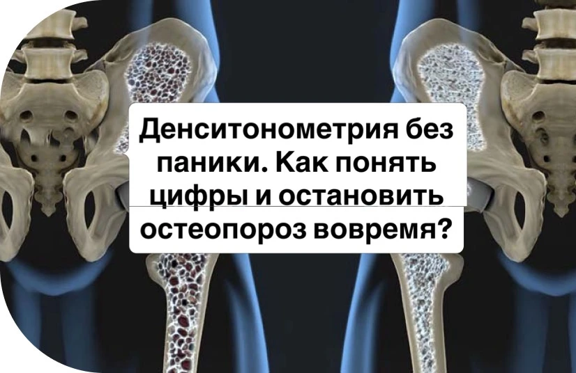 Денситонометрия без паники. Как понять цифры и остановить остеопороз вовремя?

Вы получили на руки з