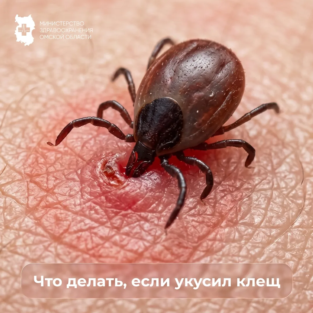Что делать, если укусил клещ?

С наступлением тепла многие из нас выбираются в поездки, на прогулки 