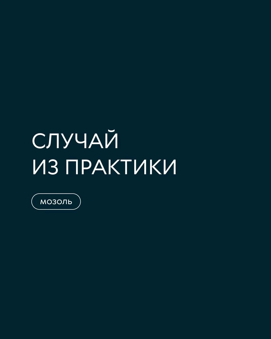 К нам обратилась девушка с жалобами на боль при ходьбе. Мозоль беспокоила давно: появлялось давление