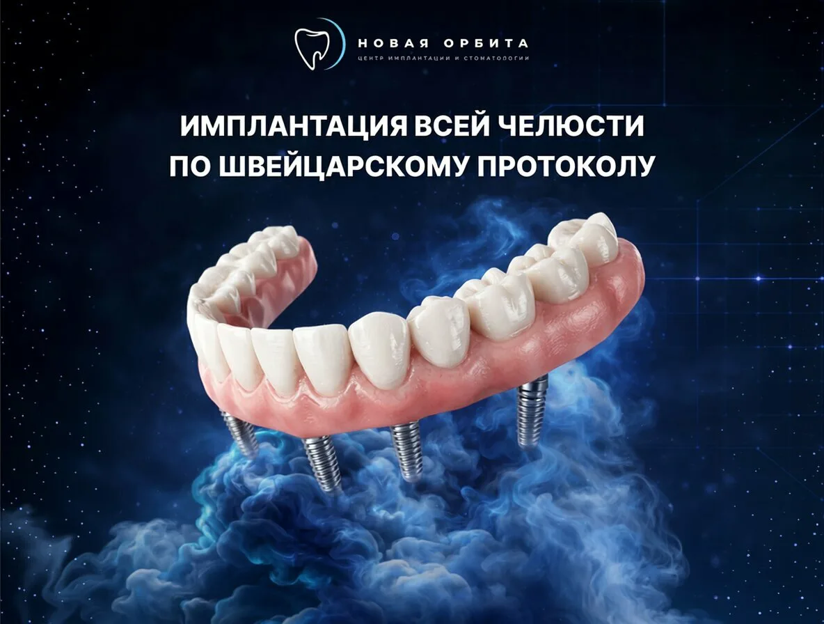 Новый зубы по акции «Всё включено»: 4 импланта + протез!

Центр имплантации и протезирования «Новая 
