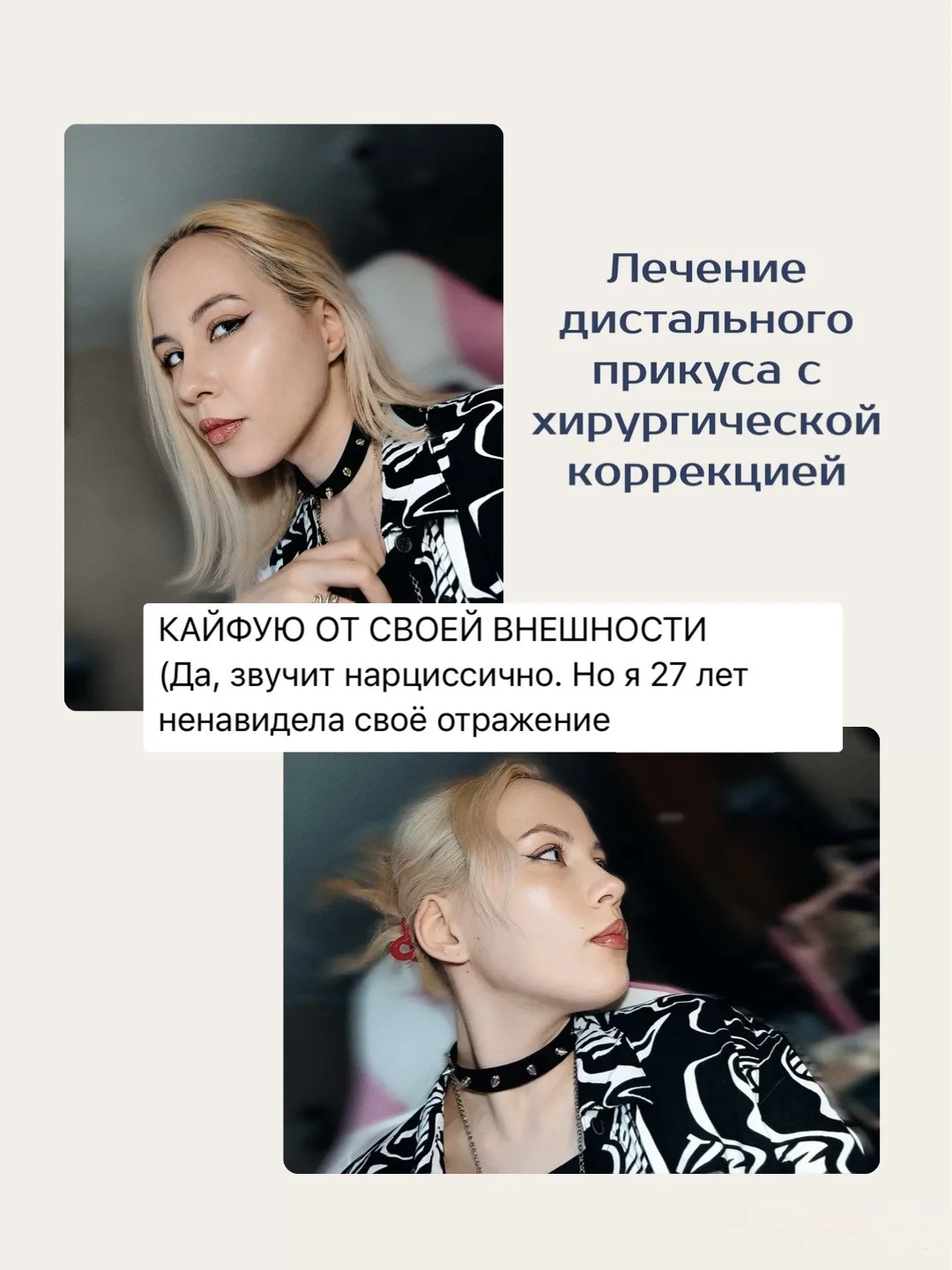 Когда брекетов недостаточно?

Не всегда нарушение прикуса связано только с положением зубов. Иногда 