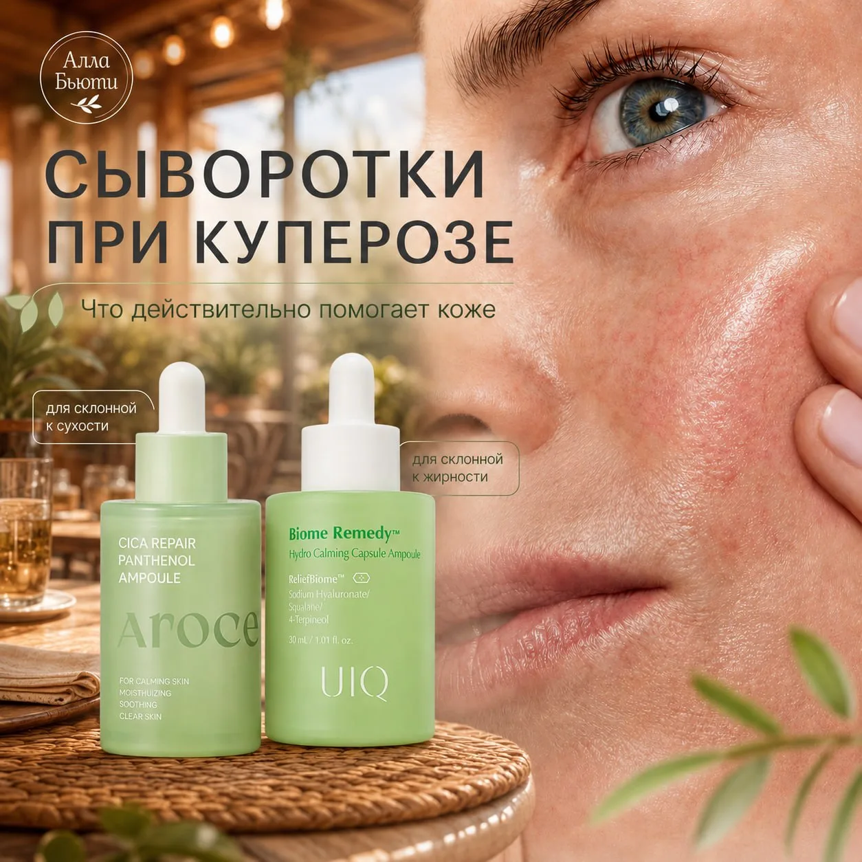 🅰️ КУПЕРОЗ. ШПАРГАЛКА И ЛЕЧЕНИЕ. 

Сыворотки при куперозе: что можно, а чего лучше избегать в Шпарг
