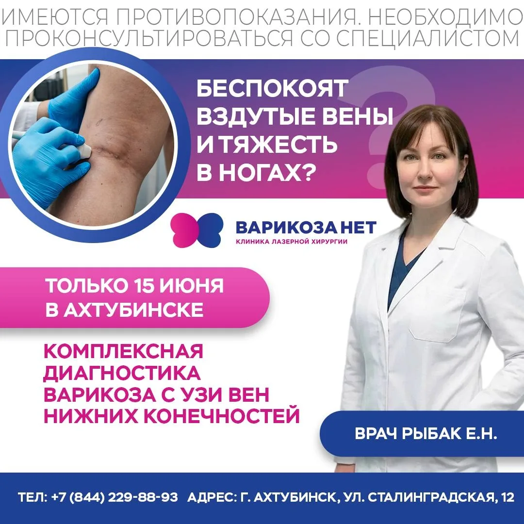 Беспокоят вздутые вены и тяжесть в ногах?
Это могут быть первые симптомы варикоза,и откладывать обс