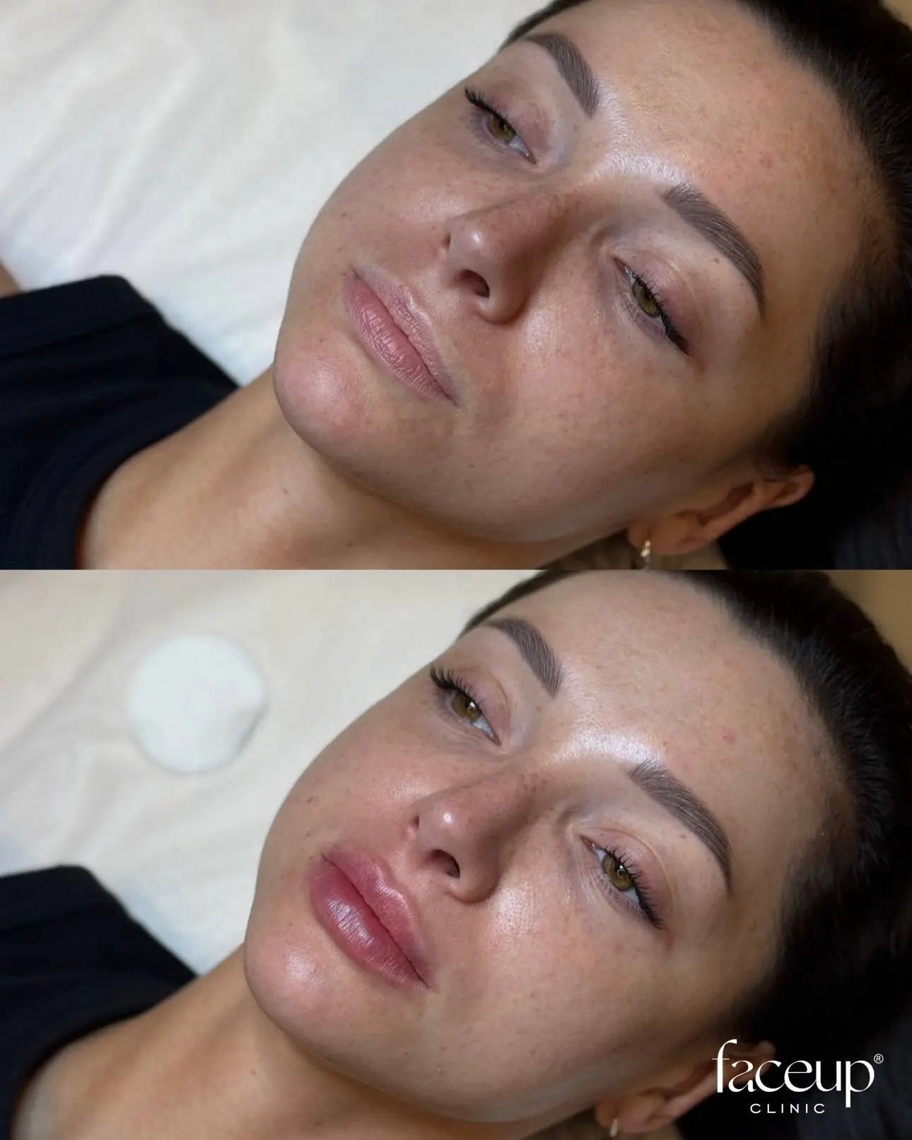 Анна Игоревна - врач-косметолог, основательница FaceUp Clinic, эксперт с деликатным почерком и научн
