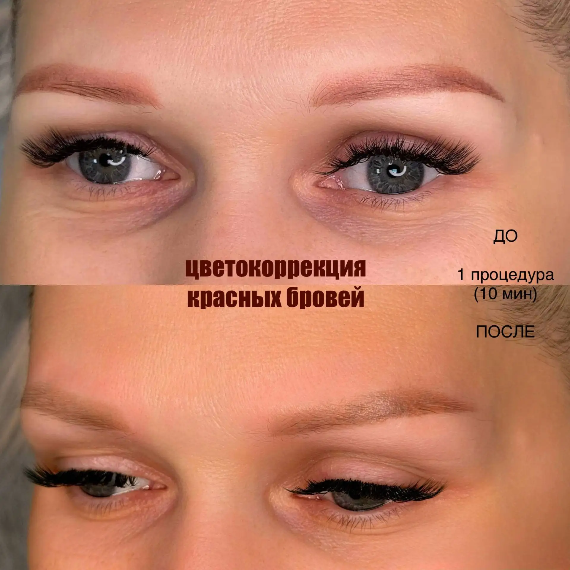 ✅Удаление Тату и Татуажа
✅Цветокоррекция 
🔵синих/🔴красных бровей

Быстро. Качественно. 
Без крови,