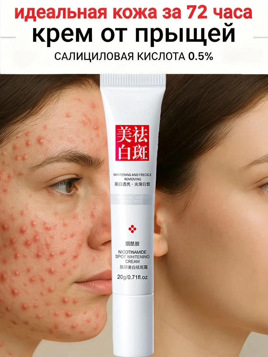 ✨ Крем от прыщей для лица, китайская чудо-мазь,крем для проблемной кожи лица от прыщей, Чистый натур