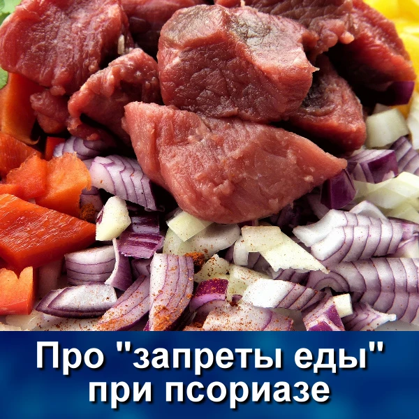 Сегодня в интернете без труда можно найти список продуктов, которые нельзя есть при псориазе. Перече
