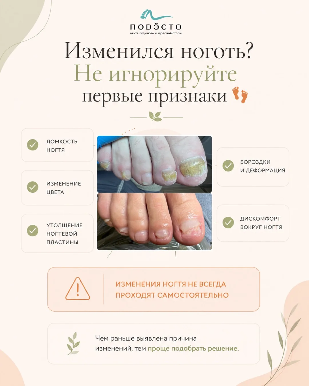 Изменился ноготь? Не всегда стоит ждать, что это пройдёт само 

Если ногтевая пластина стала более л