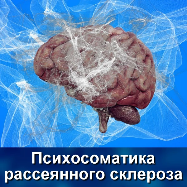 Поговорим о таком аутоиммунном заболевании, как рассеянный склероз (сокращенно РС).

Начать, наверно