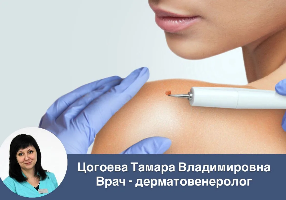 Удалите новообразования профессионально. Не ждите осложнений!

✔️ безболезненно (инфильтрационная ан