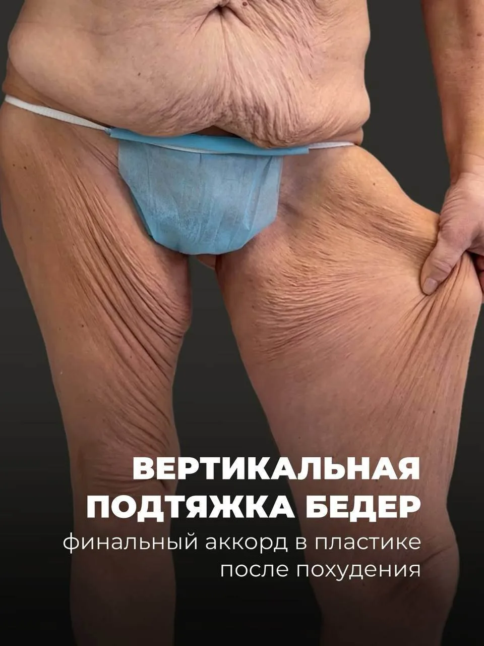 Бодилифты я показываю не так часто.
И не потому, что не хочу. Просто чаще всего результаты публикуют