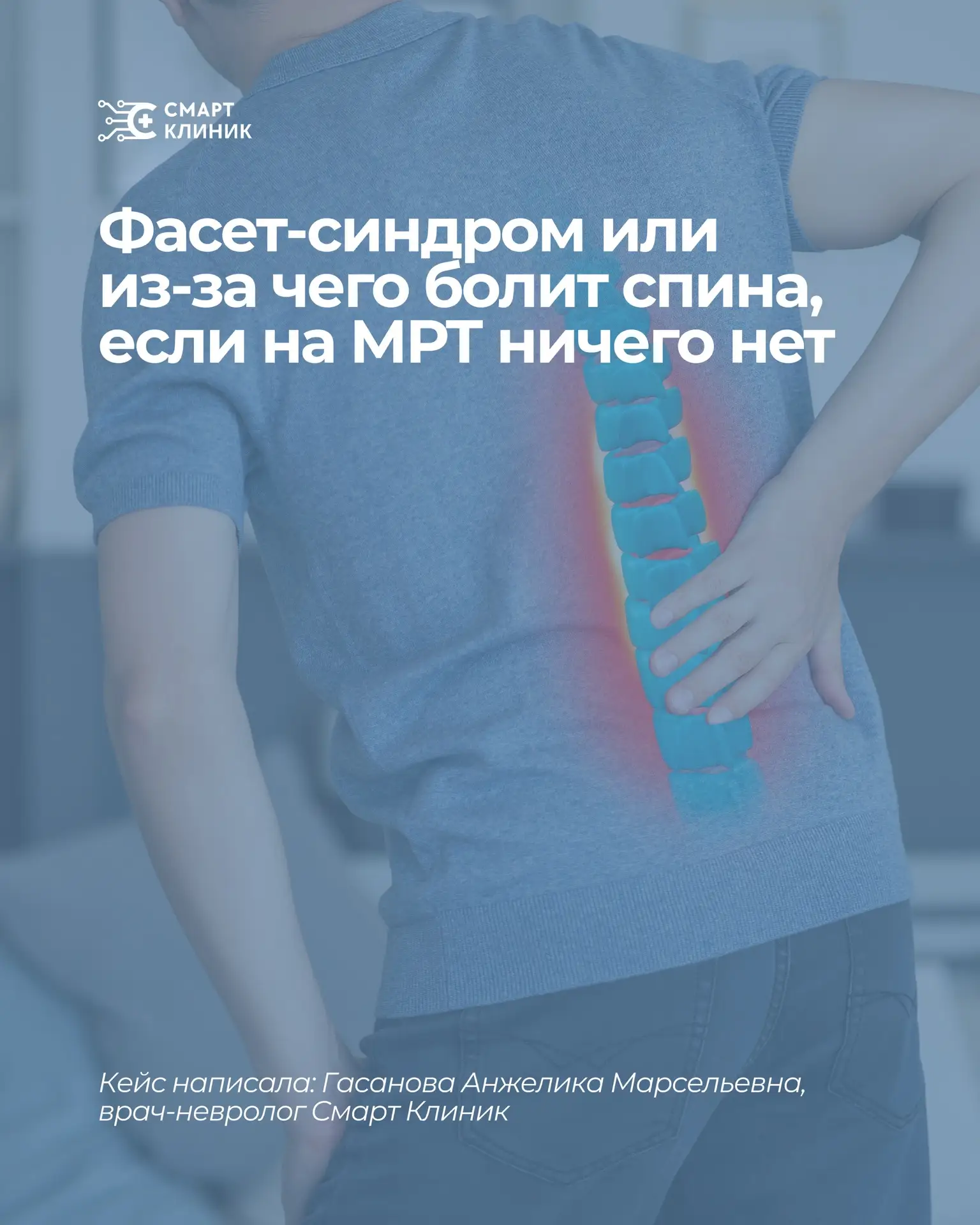 Фасет-синдром или из-за чего болит спина, если на МРТ ничего нет

Обратилась на прием пациента 35 ле