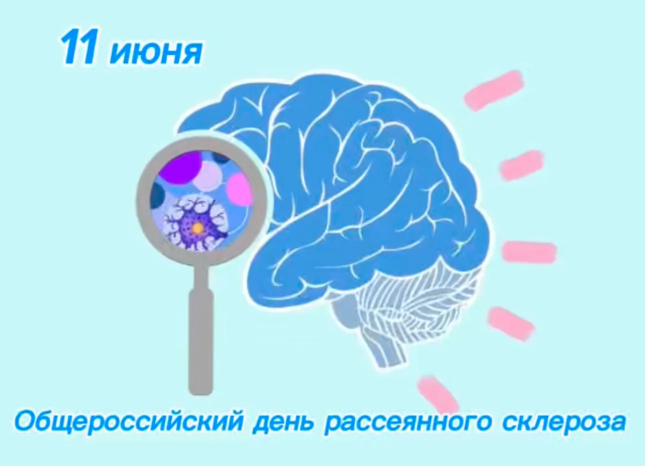 11 июня — День рассеянного склероза

Сегодня мы говорим о заболевании, которое часто путают с забывч