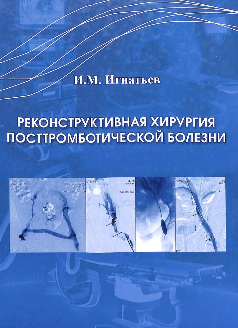 Реконструктивная хирургия посттромботической болезни / Игнатьев И.М. — 2017 г.
#хирургия
СКАЧАТЬ КНИ