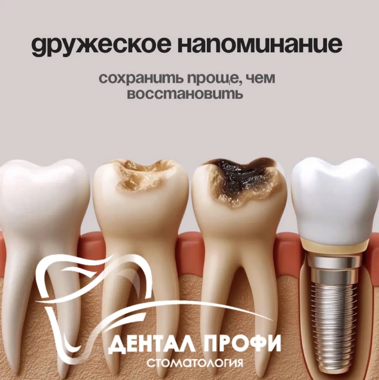 🔥 Майский фурор: почему акция закончилась и ждать ли повторения?
Честный разговор: почему идеаль