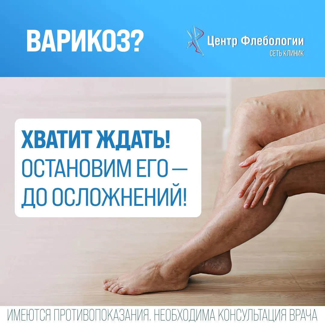 У Вас варикоз?
⠀
🚨 Жара и работы на участке - главный провоцирующий фактор осложнений варикоза.
⠀
С
