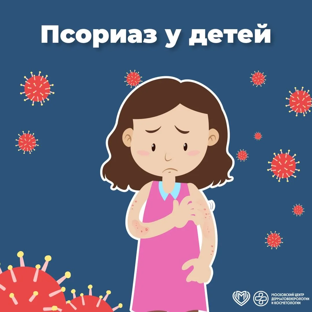 😞 К сожалению, распространенность псориаза среди хронических дерматозов у наших юных пациентов усту