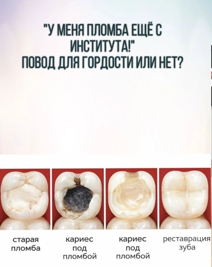 ⚠Когда пациент говорит: «У меня эта пломба ещё с института», — в голосе часто звучит гордость, ведь 