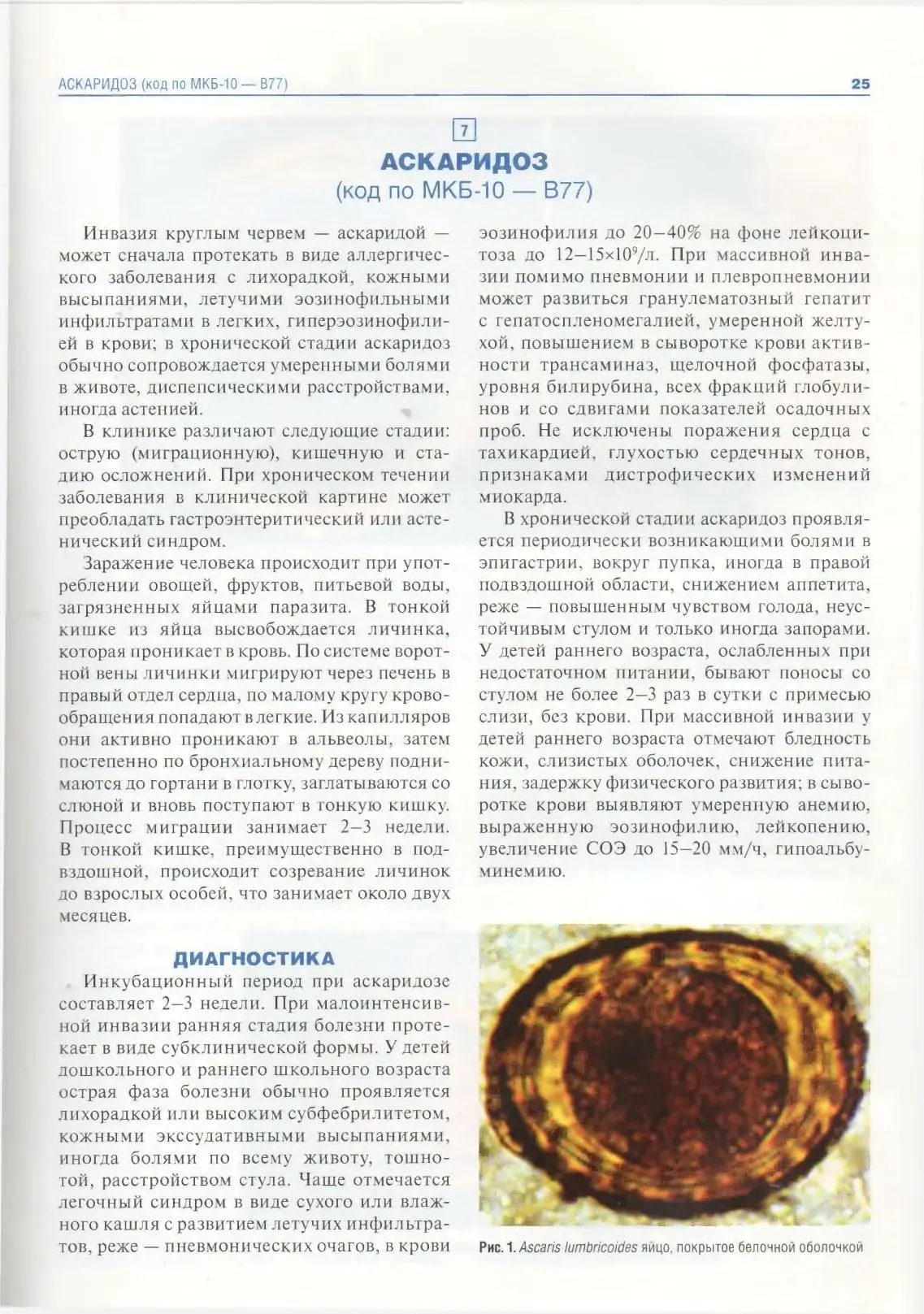 Аскаридоз