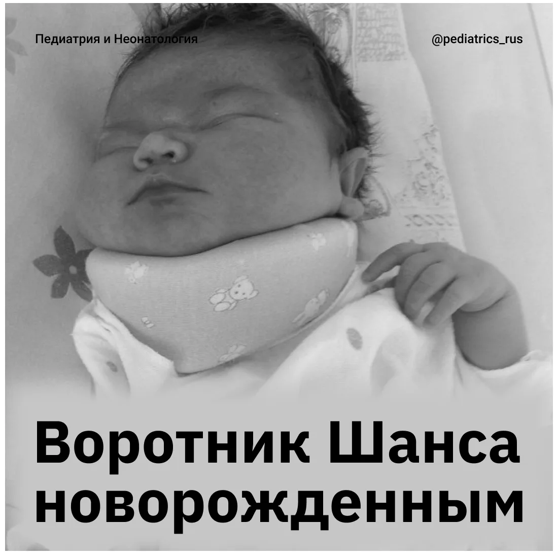 Воротник Шанса.

В некоторых роддомах новорожденным часто назначают фиксацию шейного отдела позвоноч