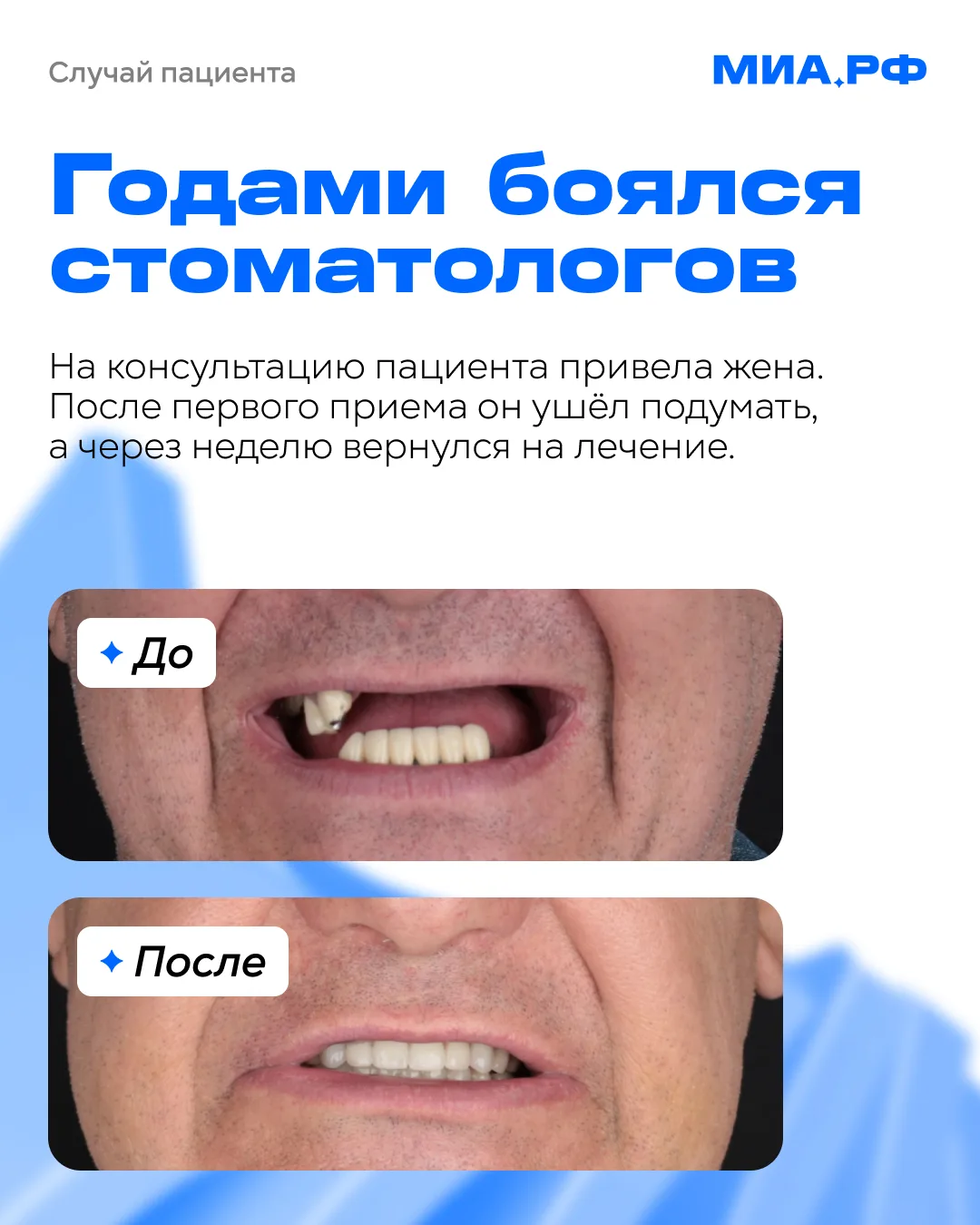«Я боюсь стоматологов...» — кому знакомо?

С таким страхом столкнулся наш пациент: он годами отклады