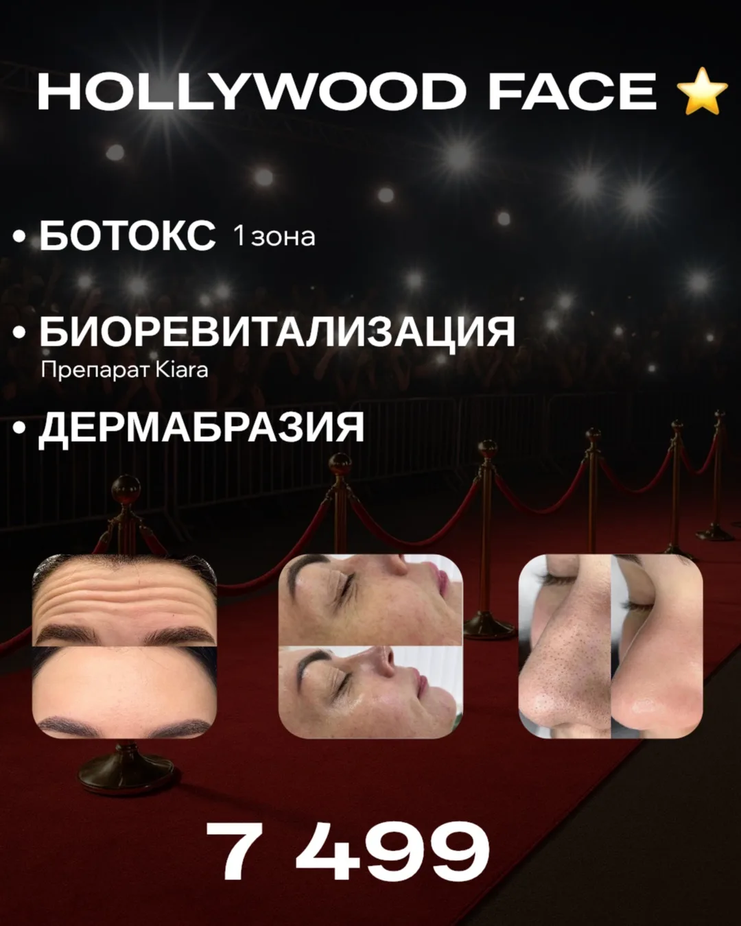 ⭐ HOLLYWOOD FACE

Для ровной, гладкой кожи и эффекта «лицо после отдыха» ✨

• Ботокс 1 зона
• Биорев