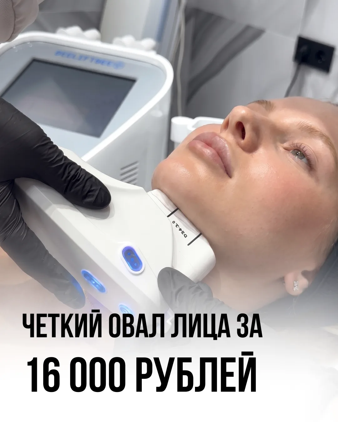 Честный расчет по зонам (Успейте до повышения цены!)

СМАС-ЛИФТИНГ В ЦИФРАХ: сколько линий нужно име