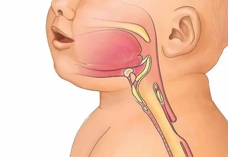 👶 Младенцы умеют дышать и глотать одновременно

Взрослый человек так не может. Если попробуешь – по