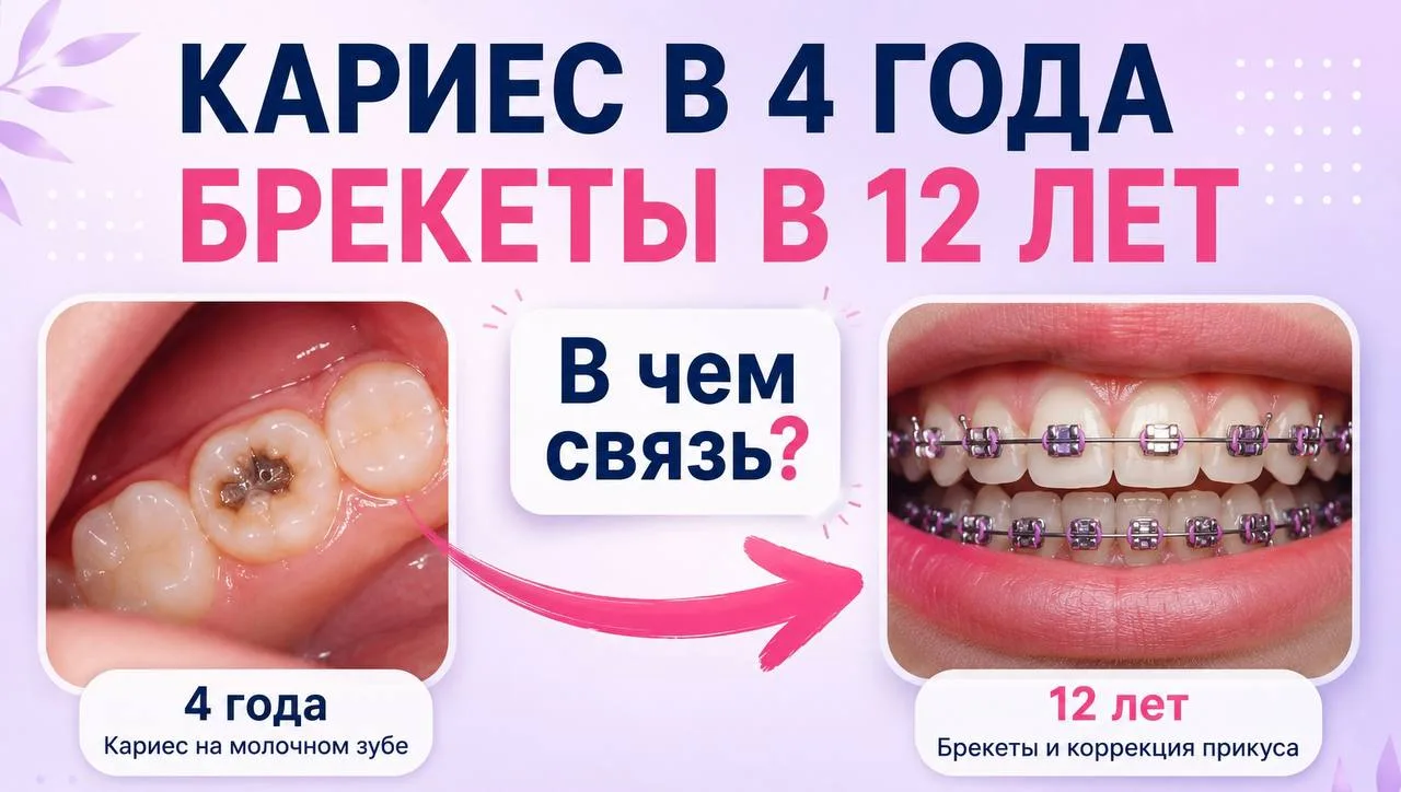 Знаете, что объединяет кариес, ротовое дыхание и брекеты?

Большинство родителей воспринимают их как