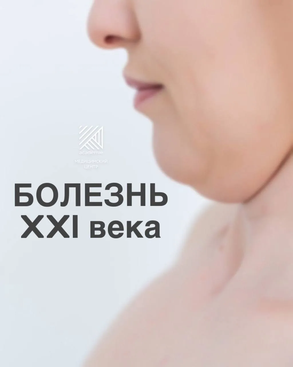 Второй подбородок — болезнь XXI века. И дело не только в возрасте.

Постоянно опущенная голова, гадж