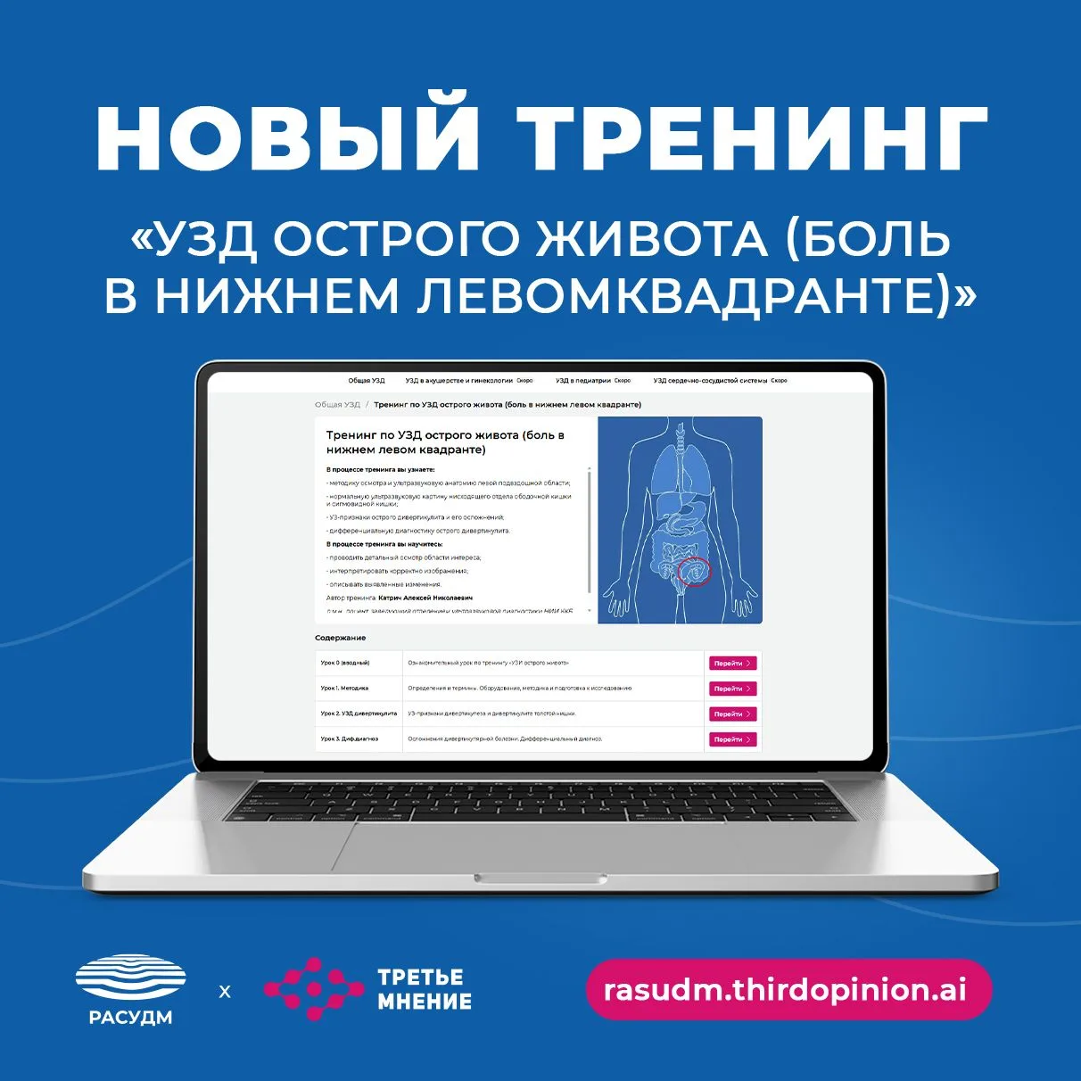 🔔На образовательной платформе РАСУДМ появился новый тренинг «УЗД острого живота (боль в нижнем лево