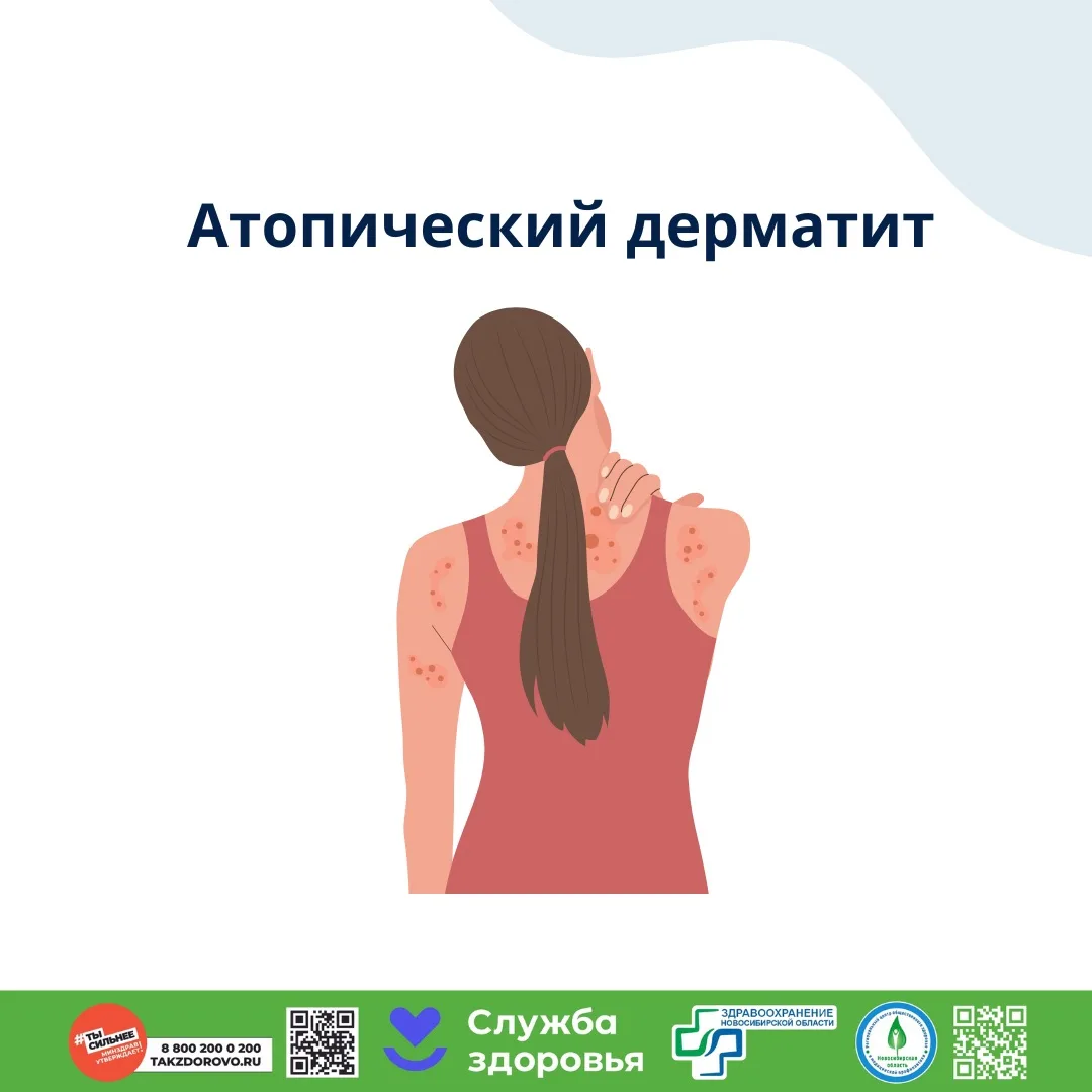 06.07.-12.07.2026 Неделя профилактики аллергических заболеваний❗️