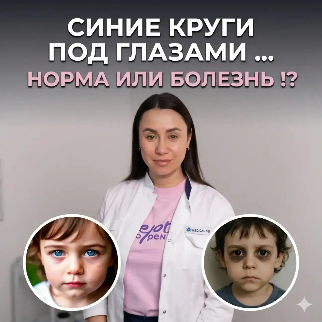 Синие круги под глазами у ребенка 
косметическая особенность или повод бежать к врачу? 

Друзья, спе