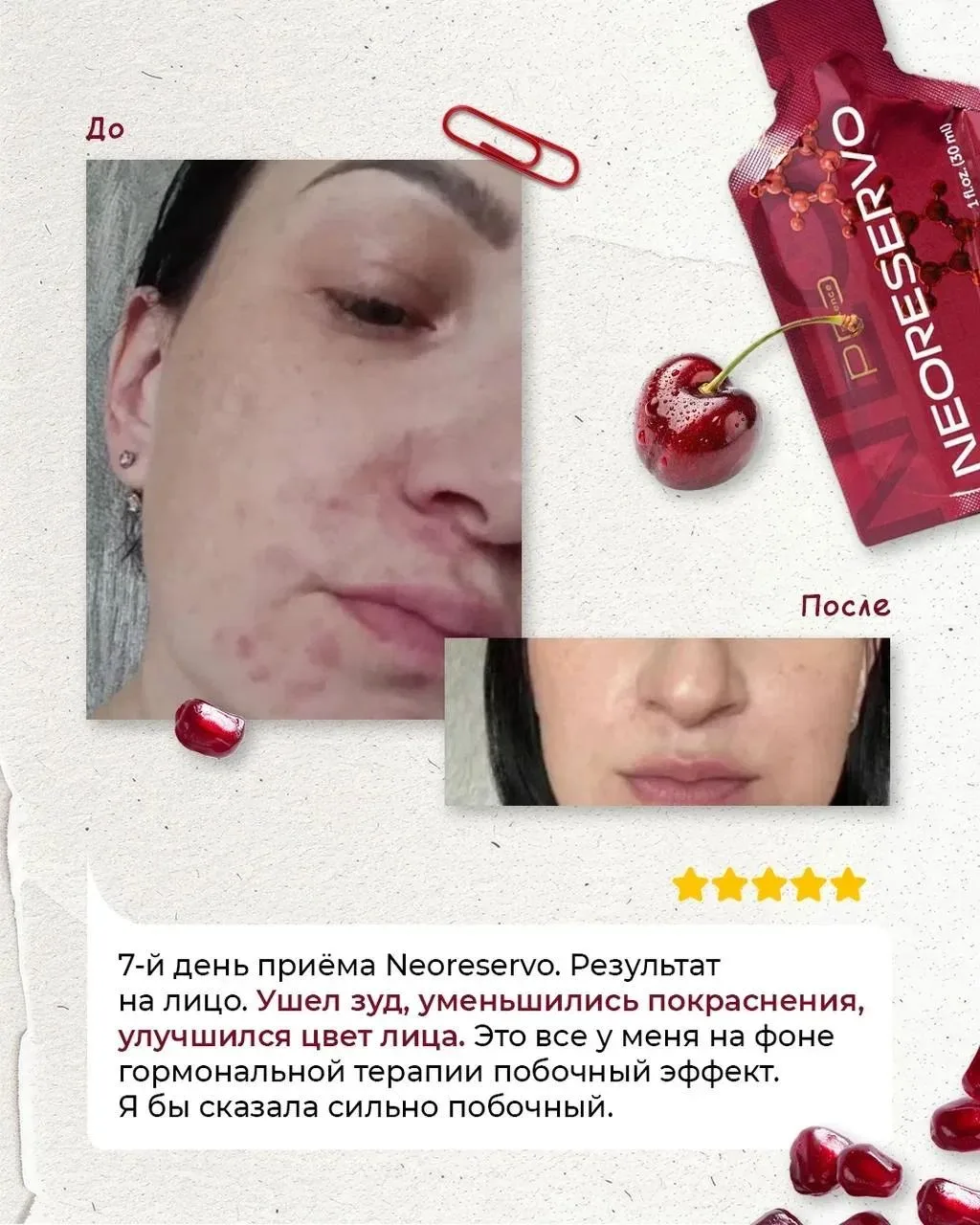 💡 А чтобы вы поняли насколько  нужен  NEORESERVO, смотрите еще карточки! 👆
В них реальные отзывы л