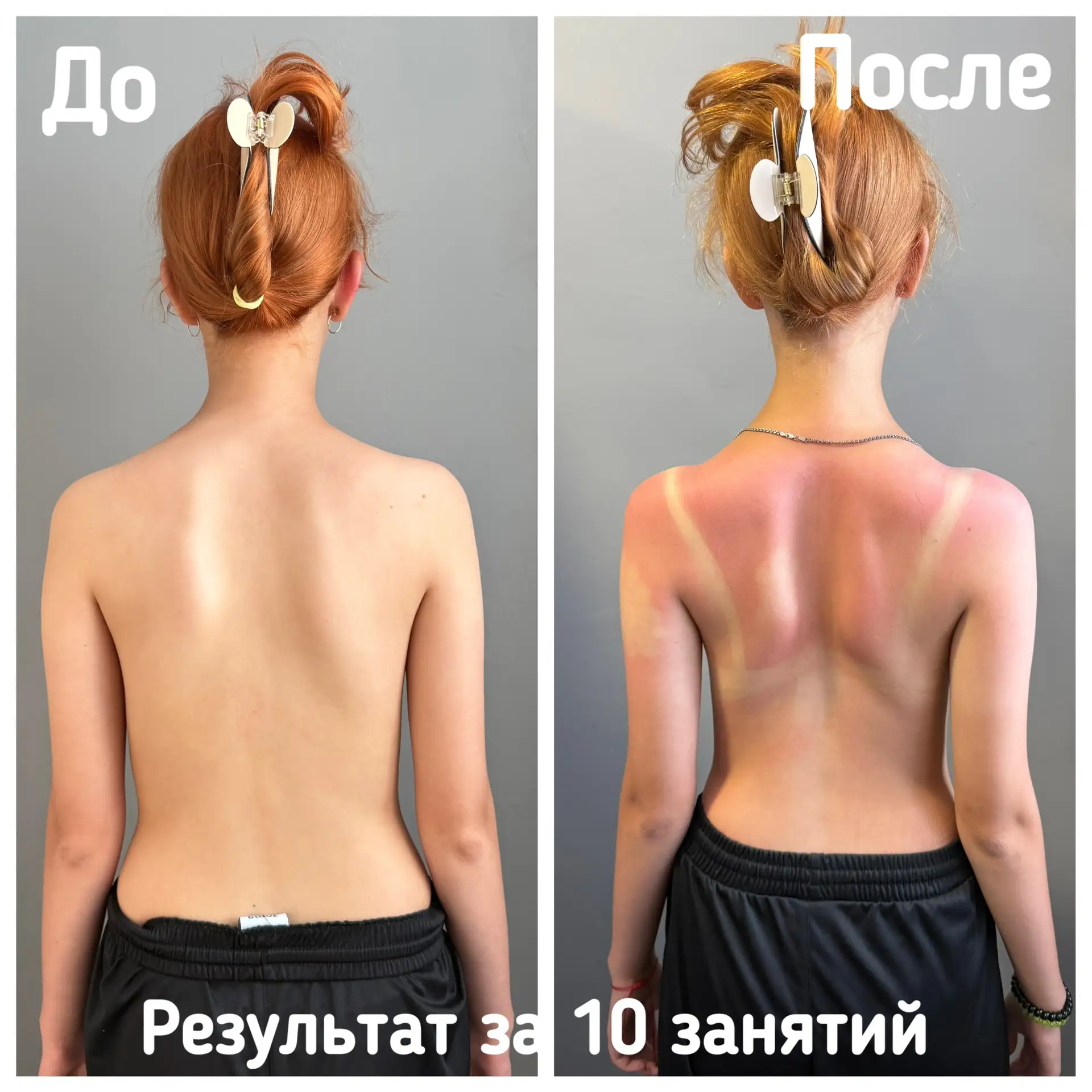 Представляем Вашему вниманию результат ребенка за 10 занятий 🔥🔥🔥
✅Прошли боли в п/о;
✅Правое плеч