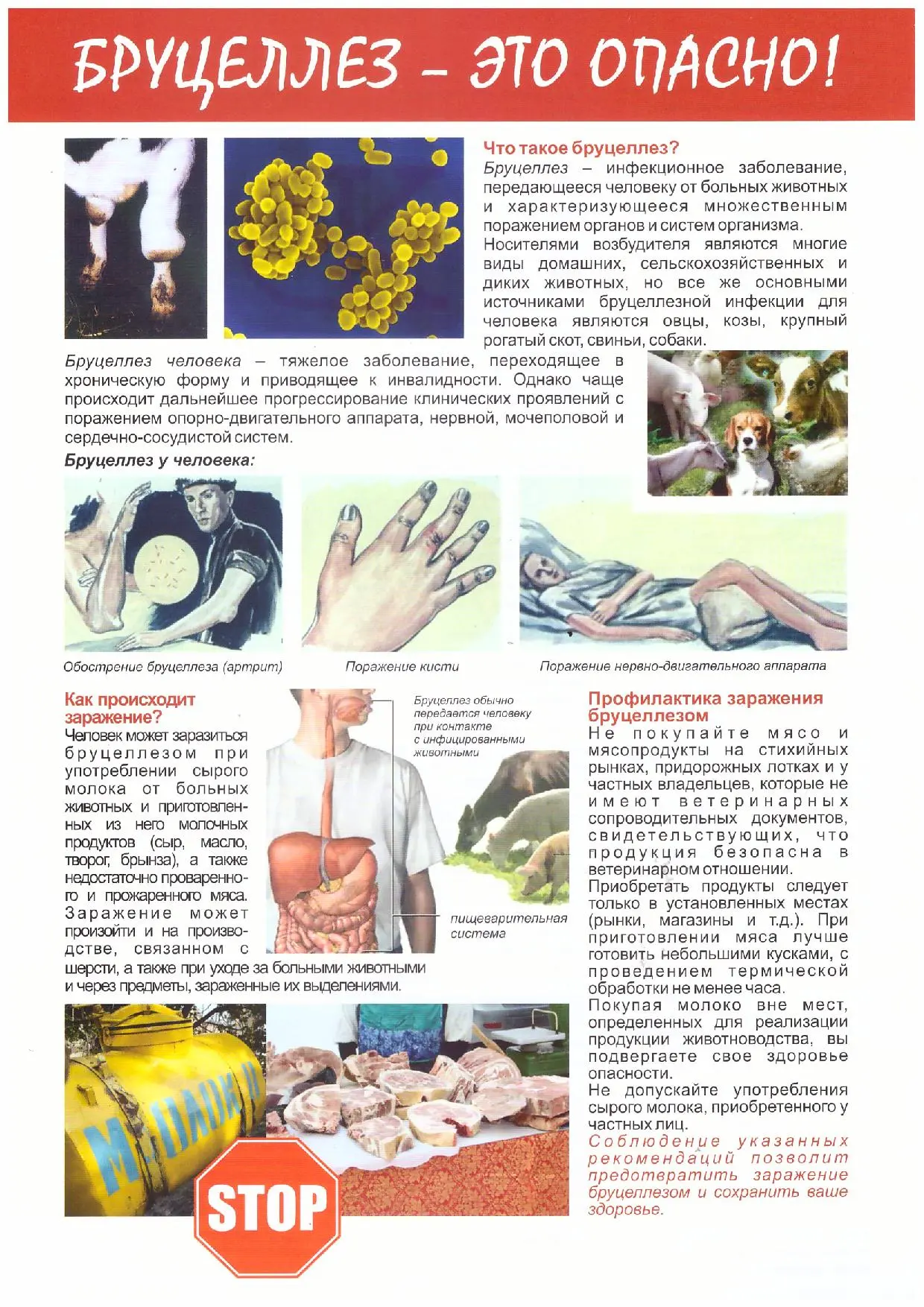 уцеллёзом.