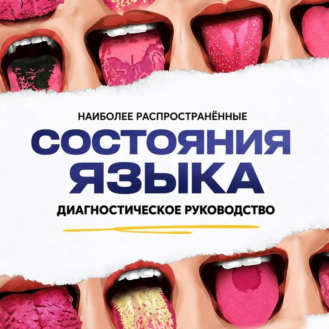✨Наиболее распространённые состояния языка

👅Диагностическое руководство для стоматологов и врачей.