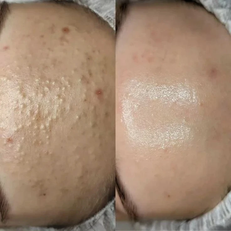 🔥 ИЩУ МОДЕЛЕЙ! Уникальная возможность попробовать процедуры по смешным ценам.

Привет! Меня зовут Л