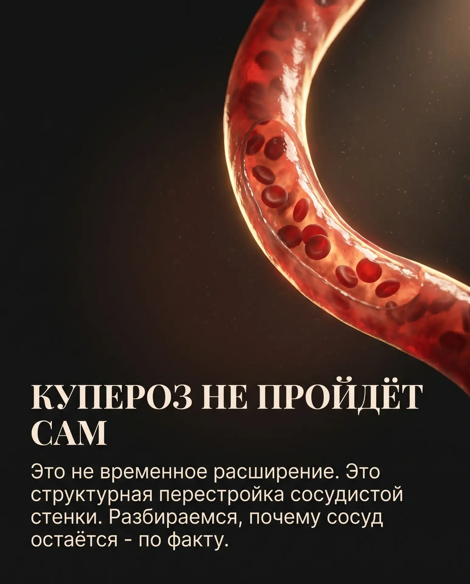 Купероз не уходит сам. И вот почему - на молекулярном уровне.

В этой карусели разбираем структурную