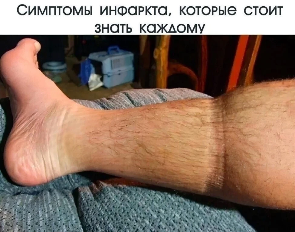 Симптомы инфаркта, которые должен знать каждый

В медицине сердечный приступ называется инфарктом ми