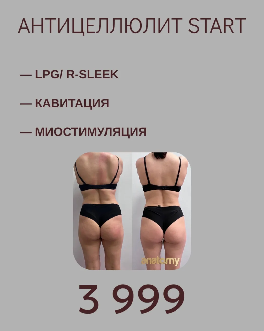 🔥 АНТИЦЕЛЛЮЛИТ START

Первый шаг к более гладкой коже и подтянутым контурам тела ✨

• LPG / R-Sleek