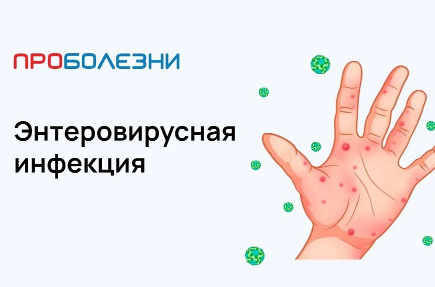 Дорогие родители!

Мы хотим напомнить вам о важности профилактики энтеровирусной инфекции. Это групп