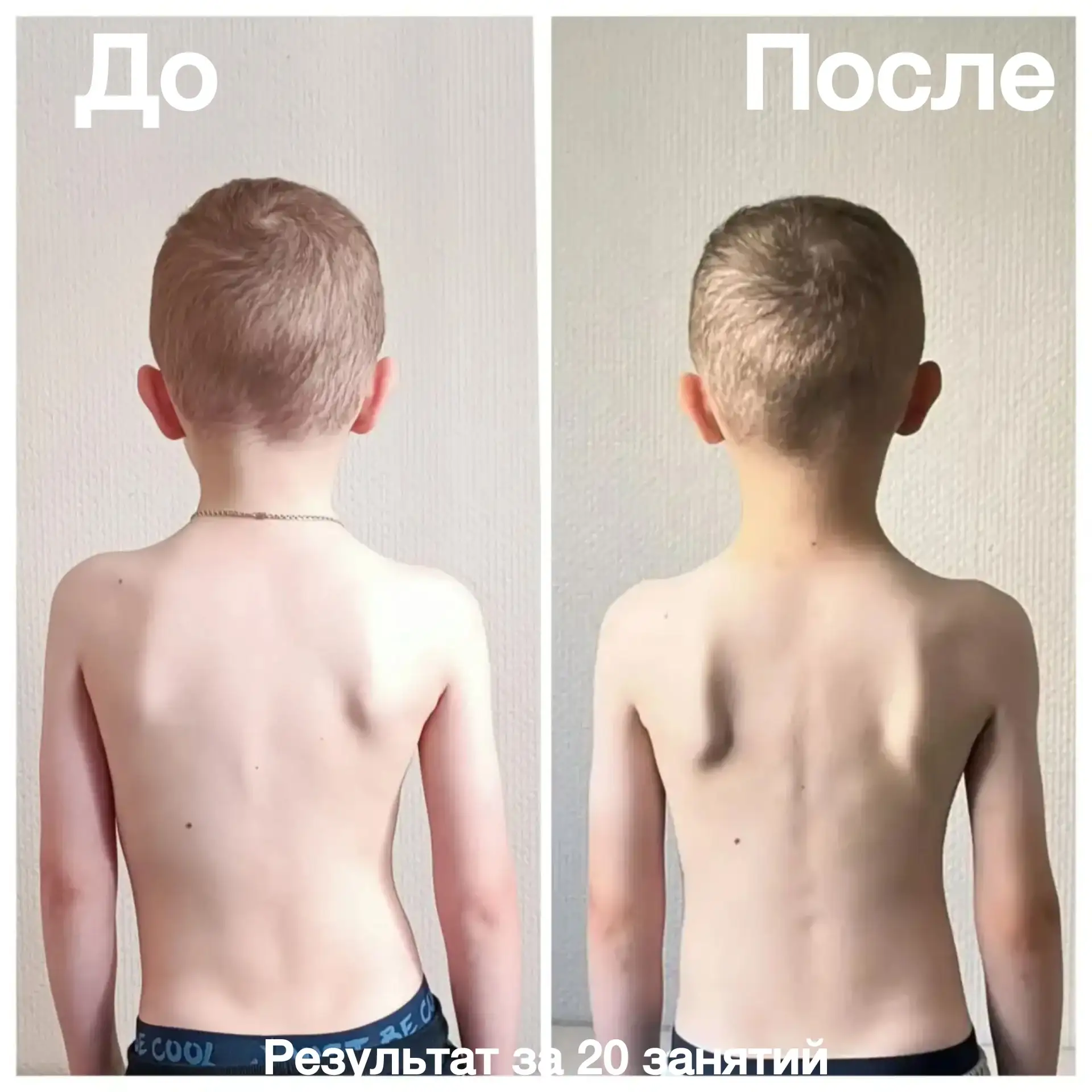 Представляем Вашему вниманию результат самого юного посетителя нашего Центра 🔥🔥🔥
✅Корпус выровнял