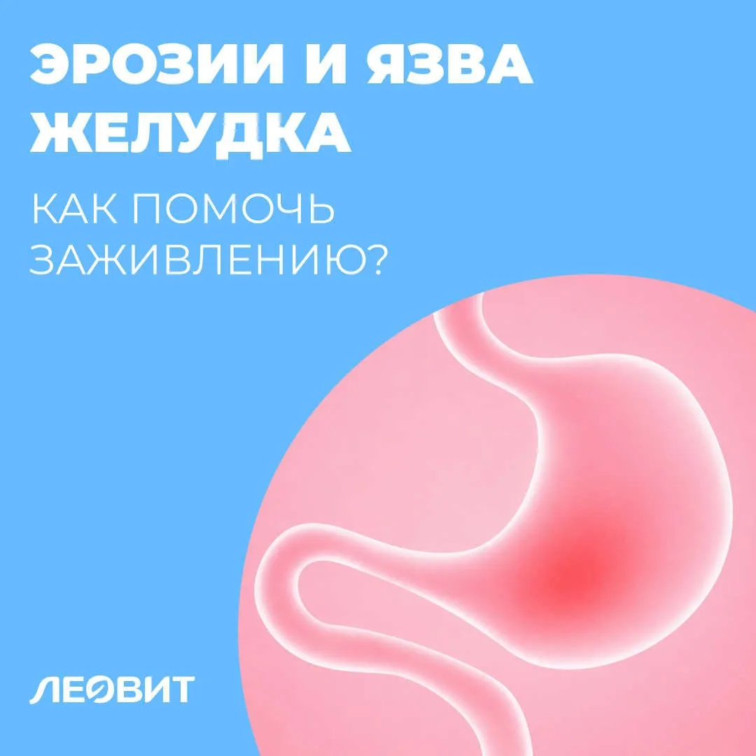 Эрозии и язва желудка. Как заживить?

Бывает, мы годами списываем дискомфорт в желудке на стресс, во