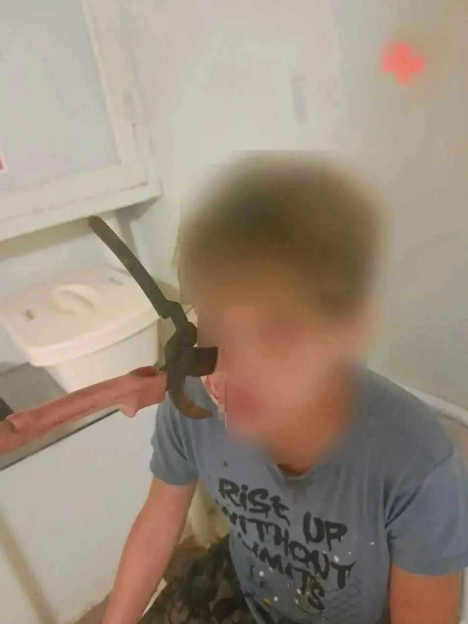 В Башкирии подросток воткнул секатор себе в лицо — лезвия едва не дошли до глазницы 
 
14-летний шко
