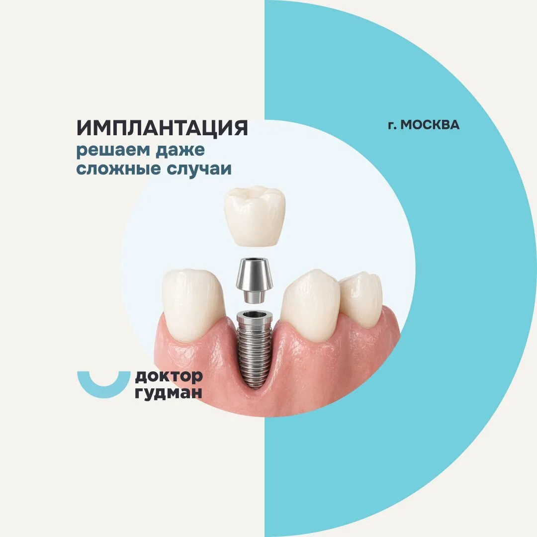 Имплант Osstem implant® c анестезией от 16 000 ₽! КТ 0 ₽

Имплантация зубов под ваш бюджет с «прозра