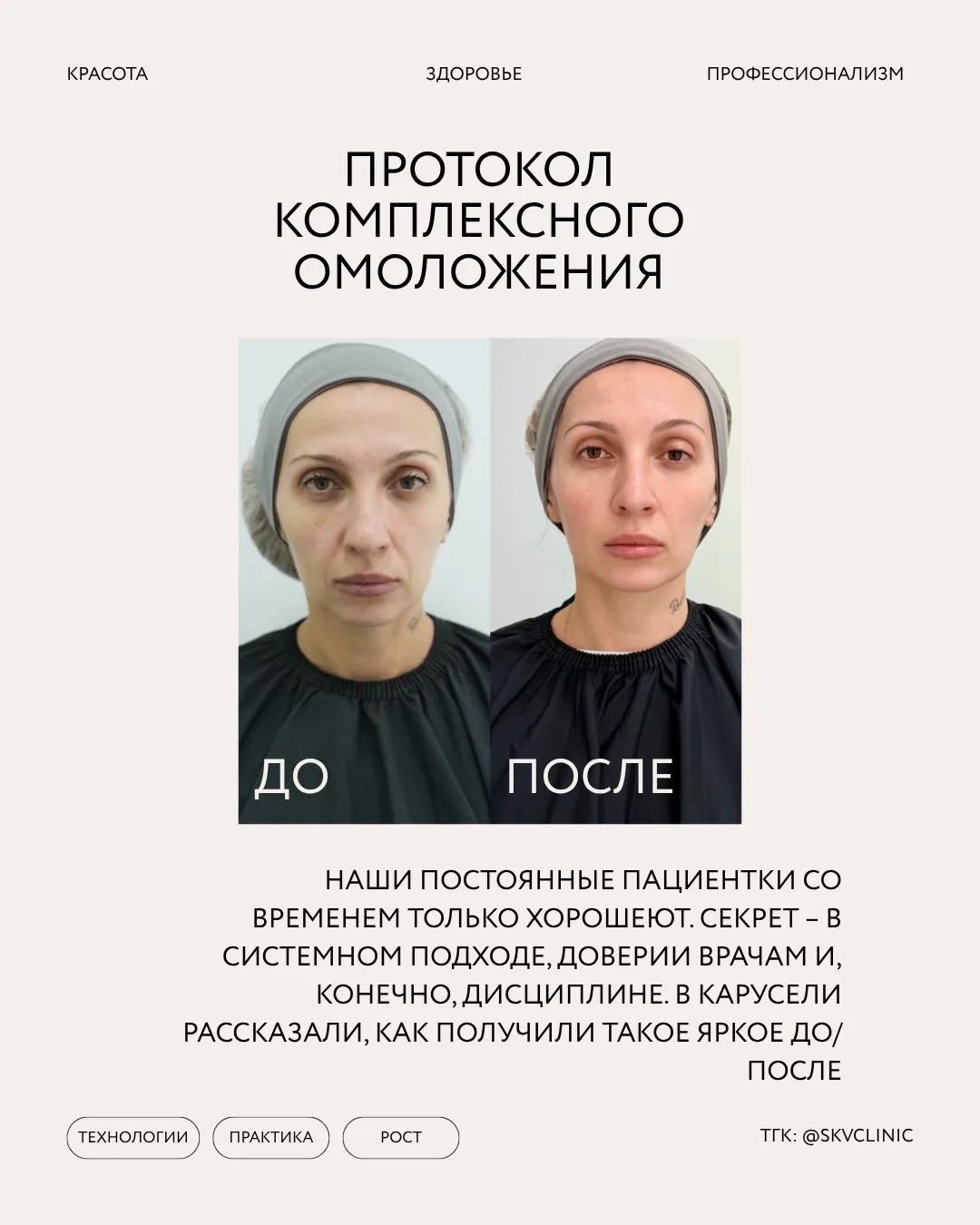Героиня этого поста – постоянная пациентка СКВ Клиники
⠀
Она регулярно посещает своего лечащего врач