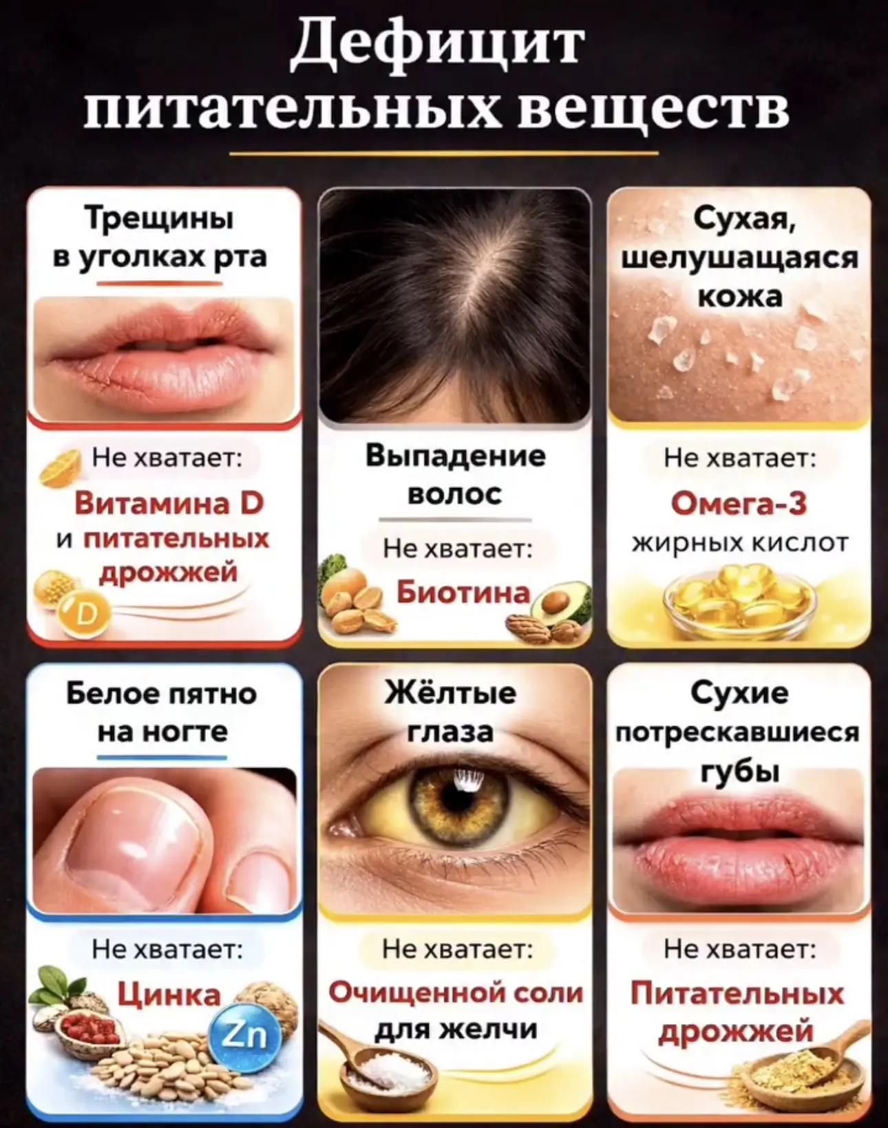 Дефицит питательных веществ, чего не хватает. 

Народные рецепты | Кирпикова