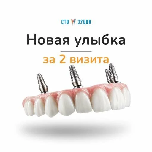 Имплантация «Все зубы на 4-х» от 78 000 ₽ в Москве

Имплантация зубов с прочностью на 20+ лет без пе
