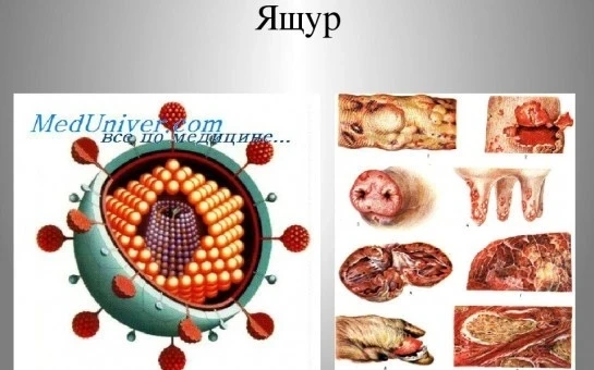 Ящур (афтозная лихорадка) — острое вирусное заболевание, которое передаётся человеку от больных живо